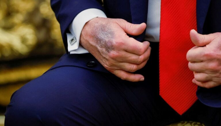 trumpin eli yine gundem oldu beyaz saraydan aciklama geldi XxUDOLWF