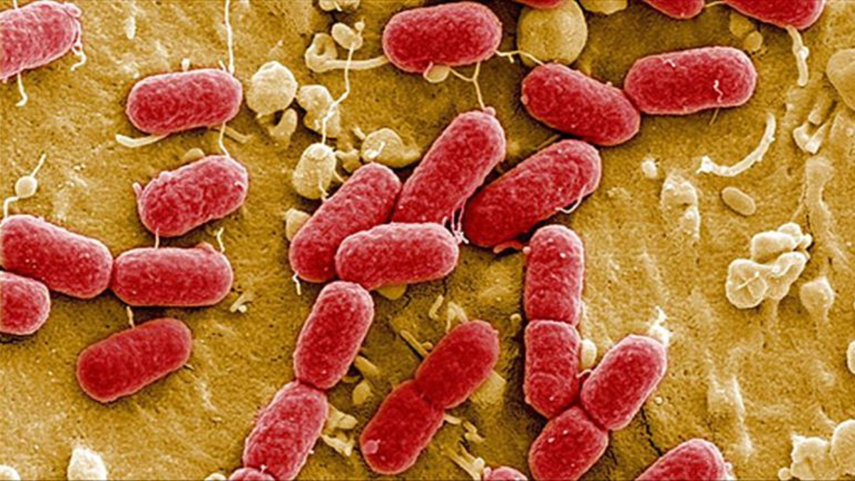 almanyada e coli salgini 2 kisi oldu 1xOwdUt5.jpg