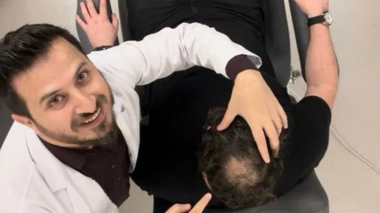 sac egzamasi seboreik dermatit ve sac ekimi ne zaman mumkun ne zaman riskli 4AVZx9rf.webp