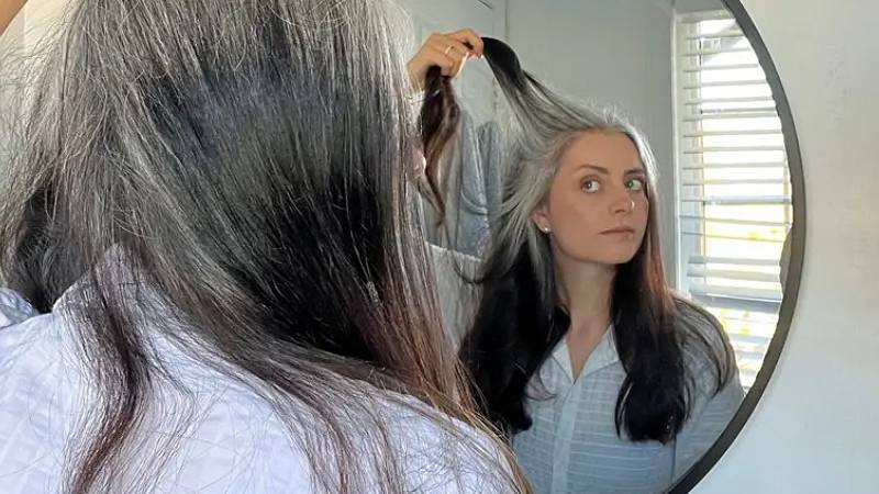 sacin erken beyazlamasinin nedenleri neler eski saclari geri getirmek mumkun mu ryDyXcxc.jpg